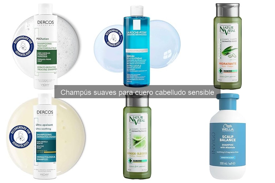 Alternativas a Champús Suaves para Cuero Cabelludo Sensible