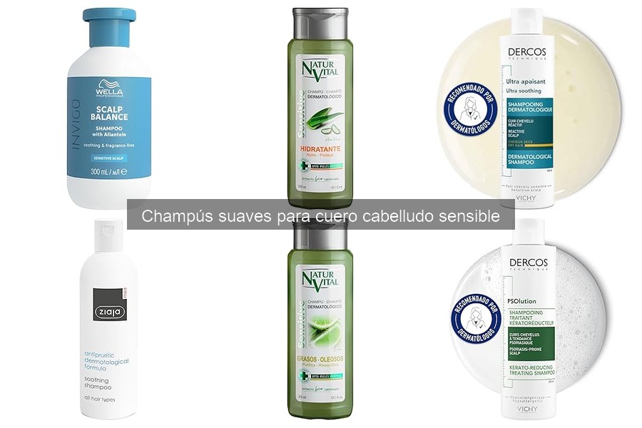 Beneficios de Champús Suaves para Cuero Cabelludo Sensible